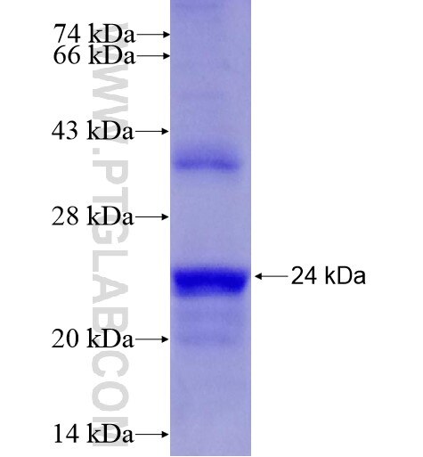 CDKN2C fusion protein ag15409 SDS-PAGE