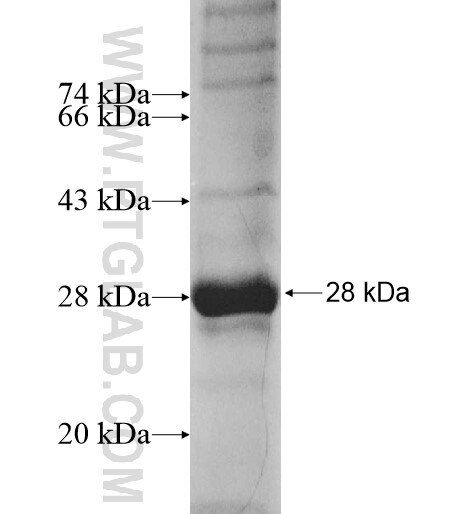 CDS1 fusion protein ag12261 SDS-PAGE