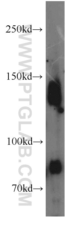 Jurkat cells were subjected to SDS PAGE followed by western blot with 14250-1-AP(CENPC1 Antibody) at dilution of 1:1000 CENPC1 western blot WB 14250-1-AP CENPC1 Antibody CENP-C; CENPC; MIF2; hcp-4