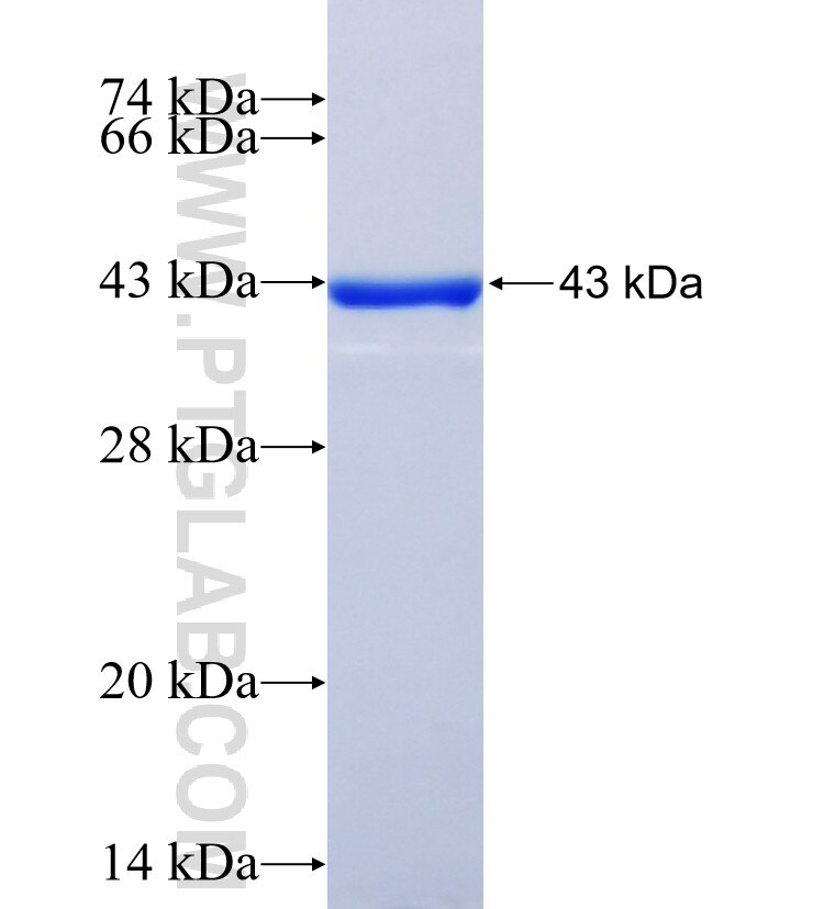 CEP164 fusion protein ag17570 SDS-PAGE