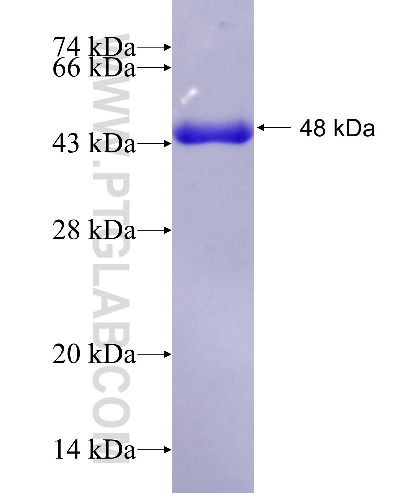 CEP63 fusion protein ag9227 SDS-PAGE