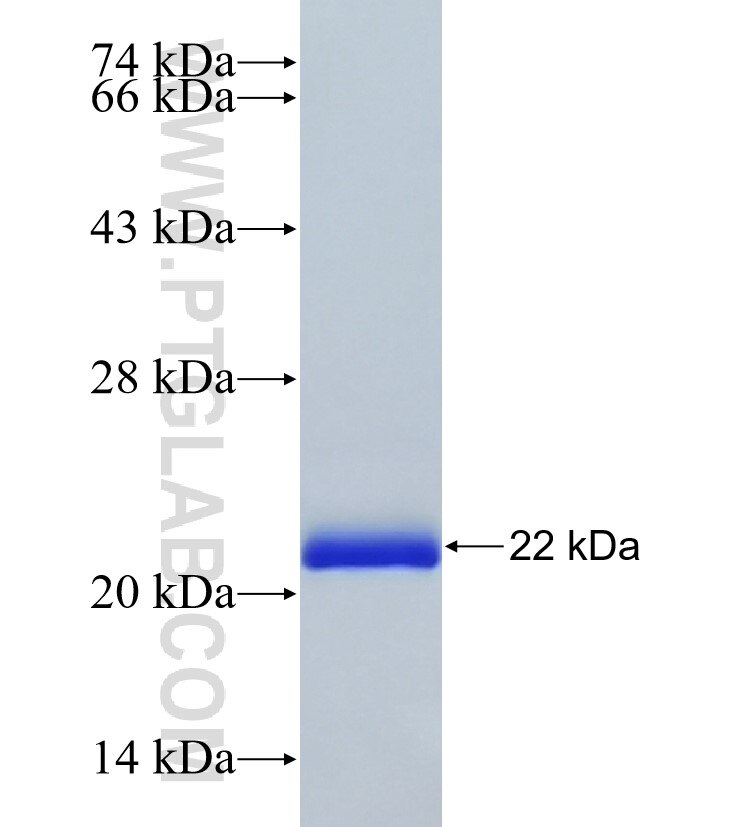 CETN2 fusion protein ag8567 SDS-PAGE