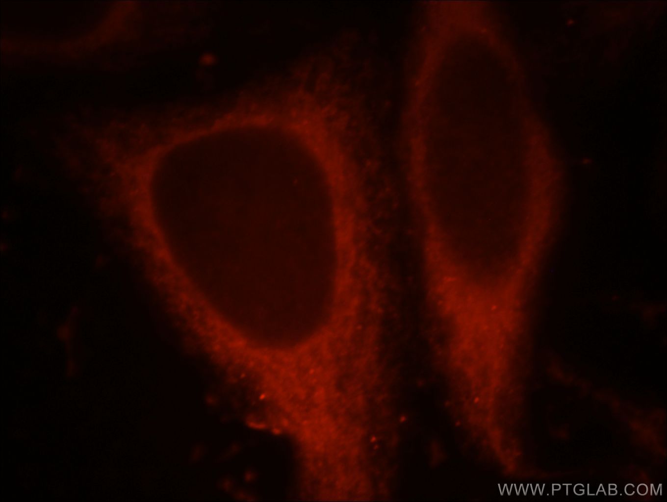 CHIA Immunofluorescence IF 21484-1-AP CHIA Antibody 2200003E03Rik; AMCase; CHIT2; DKFZp313J1722; RP5-1125M8.1; TSA1902