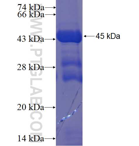 CHIC2 fusion protein ag3901 SDS-PAGE