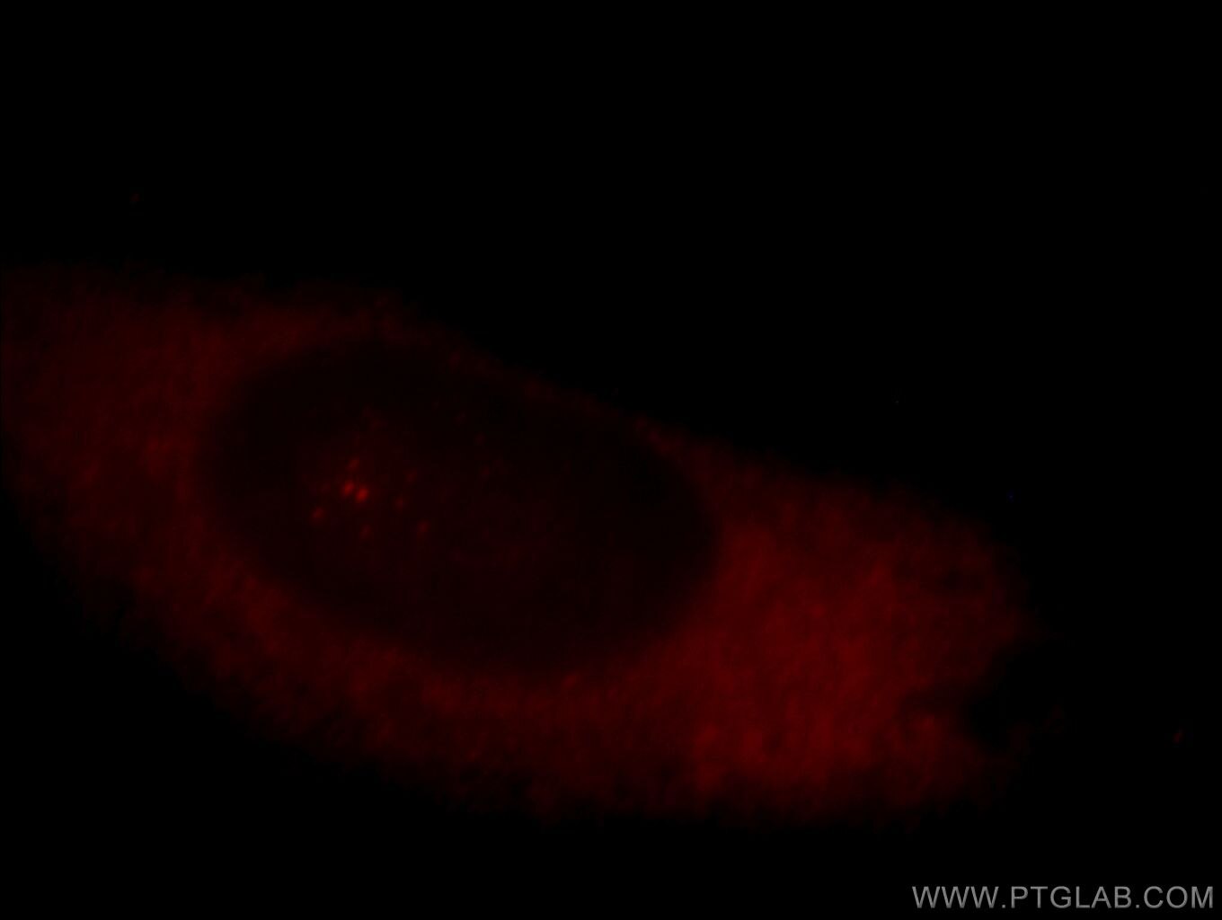 CLASP1 Immunofluorescence IF 20803-1-AP CLASP1 Antibody DKFZp686D1968; DKFZp686H2039; FLJ33821; FLJ41222; KIAA0622; MAST1; MGC131895