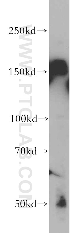 CLASP1 western blot WB 20803-1-AP CLASP1 Antibody DKFZp686D1968; DKFZp686H2039; FLJ33821; FLJ41222; KIAA0622; MAST1; MGC131895