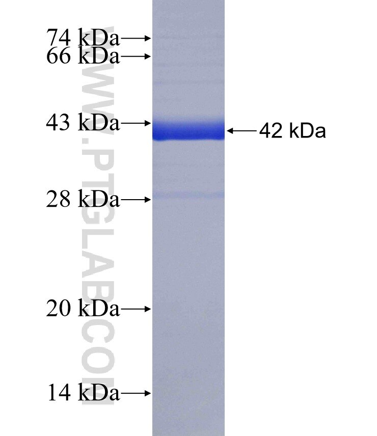 CLC fusion protein ag18569 SDS-PAGE