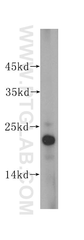 mouse small intestine tissue were subjected to SDS PAGE followed by western blot with 16195-1-AP(CLDN4-specific Antibody) at dilution of 1:800 CLDN4-specific western blot WB 16195-1-AP CLDN4-specific Antibody CPE-R; CPER; CPETR; CPETR1; WBSCR8; hCPE-R