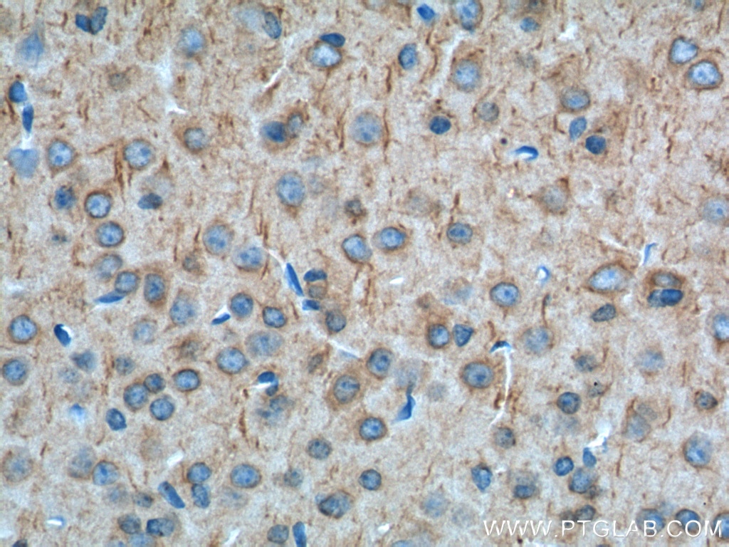 cannabinoid receptor 1 antibody 17978 1 ap proteintech
