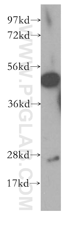 CNTFR western blot WB 10796-1-AP CNTFR Antibody MGC1774