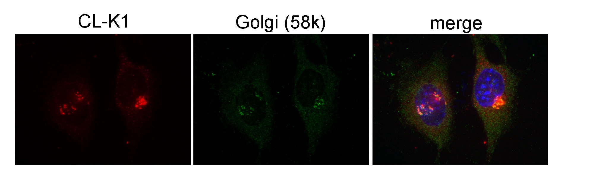 IF result(confocal image) of CL-K1 in ATCD5 cell show Golgi localization from Prof. Philip L. Beales. COLEC11 IF 15269-1-AP COLEC11 Antibody CL-K1-I; CL-K1-II; CL-K1-IIa; CL-K1-IIb; CLK1; DKFZp686N1868; MGC3279