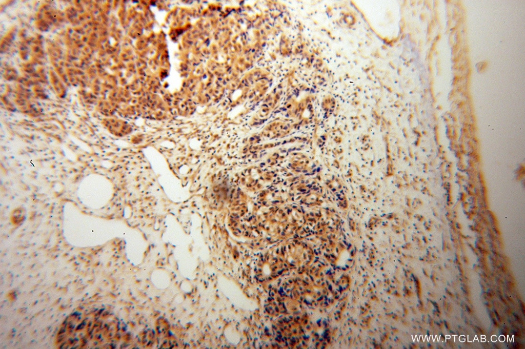 COMMD1 IHC Immunohistochemical 11938-1-AP COMMD1 Antibody C2orf5; MGC27155; MURR1