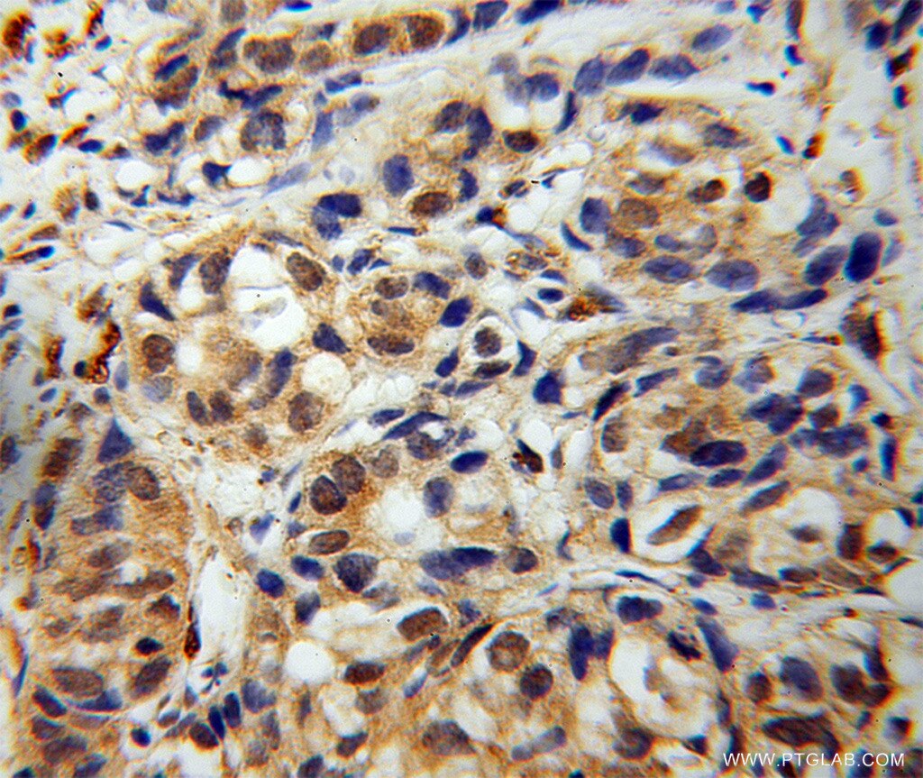 COMMD1 IHC Immunohistochemical 11938-1-AP COMMD1 Antibody C2orf5; MGC27155; MURR1