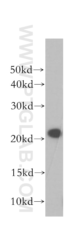 COMMD1 western blot WB 11938-1-AP COMMD1 Antibody C2orf5; MGC27155; MURR1