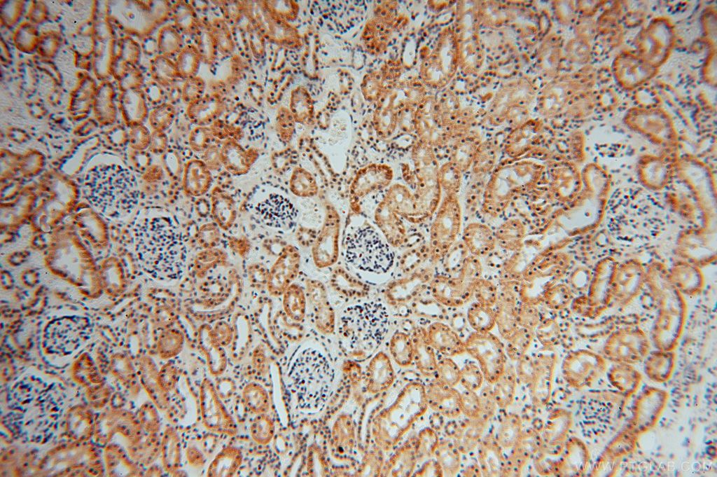COPS7A IHC Immunohistochemical 16628-1-AP COPS7A Antibody CSN7A; MGC110877