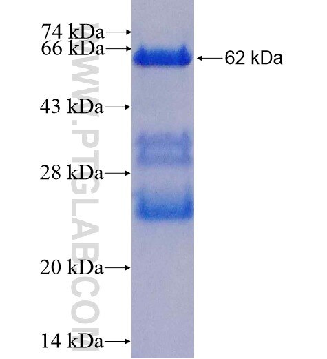 COQ9 fusion protein ag6645 SDS-PAGE