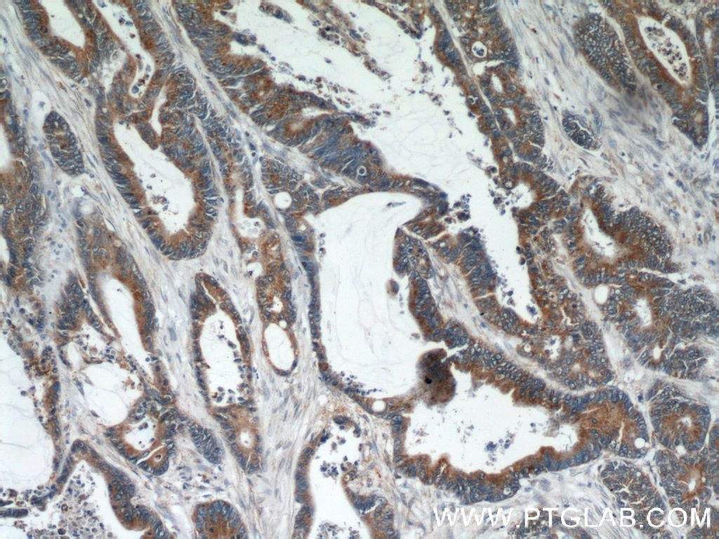 COX2 IHC Immunohistochemical 55070-1-AP COX2 Antibody MTCO2