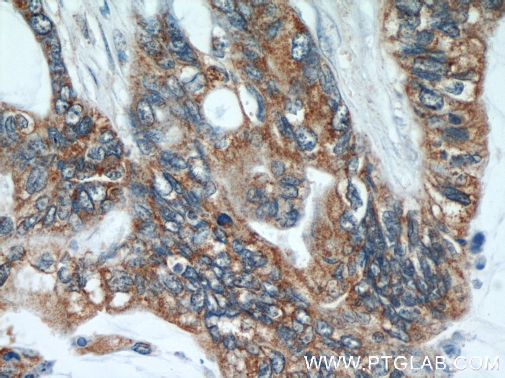 COX2 IHC Immunohistochemical 55070-1-AP COX2 Antibody MTCO2