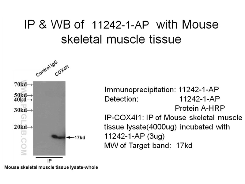 COXIV IP 11242-1-AP COXIV Antibody COX4; COXIV; MGC72016