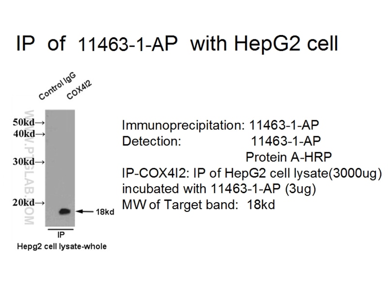 COX4I2 IP 11463-1-AP COX4I2 Antibody COX4; COX4-2; COX4B; COX4L2; COXIV-2; dJ857M17.2