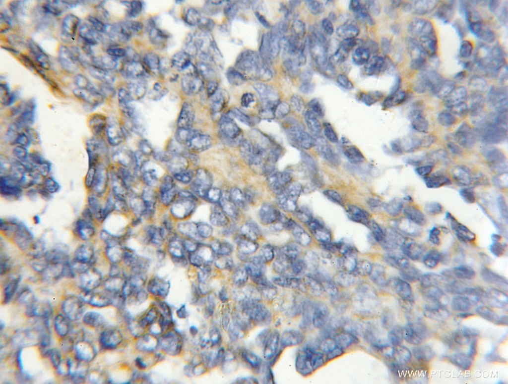 COX4I2 IHC Immunohistochemical 11463-1-AP COX4I2 Antibody COX4; COX4-2; COX4B; COX4L2; COXIV-2; dJ857M17.2