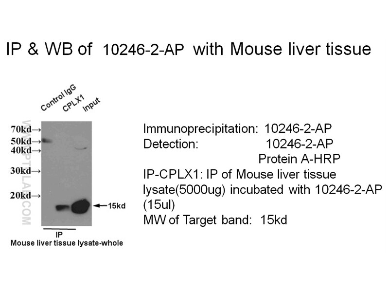 IP result of CPLX1 antibody (10246-2-AP for IP and Detection) with mouse liver tissue lysate. CPLX1 IP 10246-2-AP CPLX1 Antibody CPX-I; CPX1
