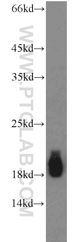 mouse brain tissue were subjected to SDS PAGE followed by western blot with 10246-2-AP(CPLX1 Antibody) at dilution of 1:1500 CPLX1 western blot WB 10246-2-AP CPLX1 Antibody CPX-I; CPX1