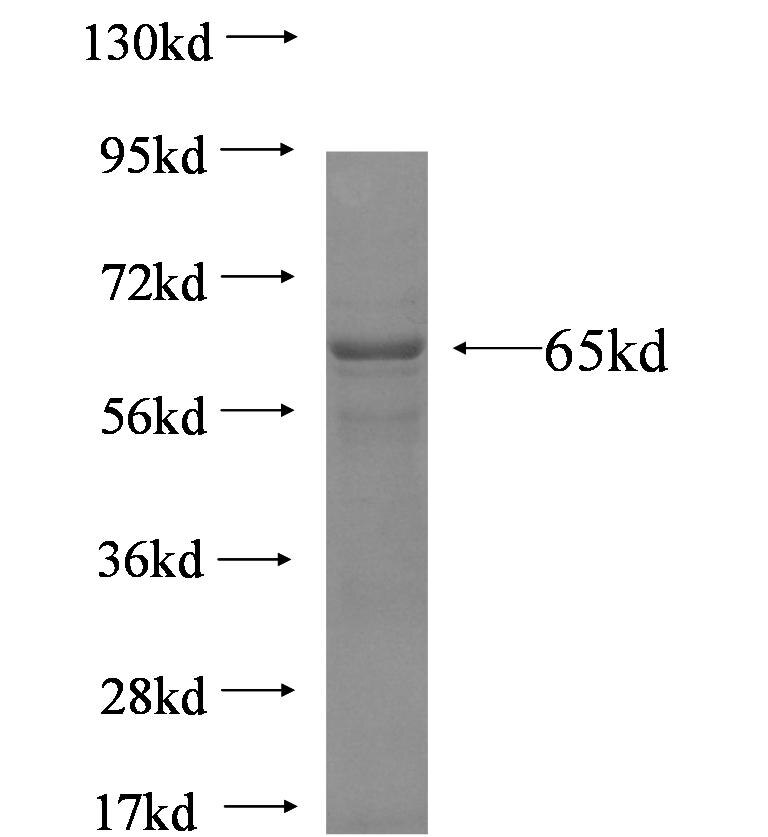 CPSF3L fusion protein ag8399 SDS-PAGE