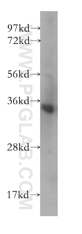 human brain tissue were subjected to SDS PAGE followed by western blot with 10944-1-AP(CRH Antibody) at dilution of 1:800 CRH western blot WB 10944-1-AP CRH Antibody CRF