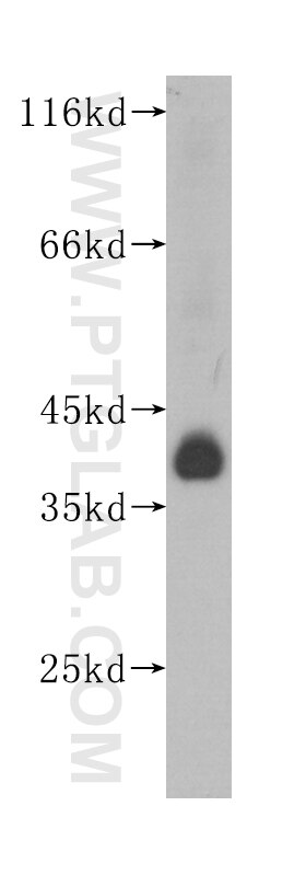 Human brain were subjected to SDS PAGE followed by western blot with 60168-1-Ig(CRH Antibody) at dilution of 1:300 CRH western blot WB 60168-1-Ig CRH Antibody CRF