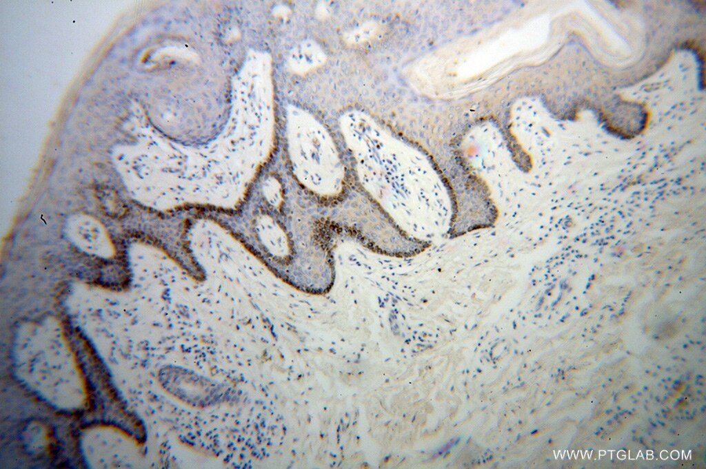 UNR; CSDE1 IHC Immunohistochemical 13319-1-AP UNR; CSDE1 Antibody D1S155E; DKFZp779B0247; DKFZp779J1455; FLJ26882; RP5-1000E10.3; UNR