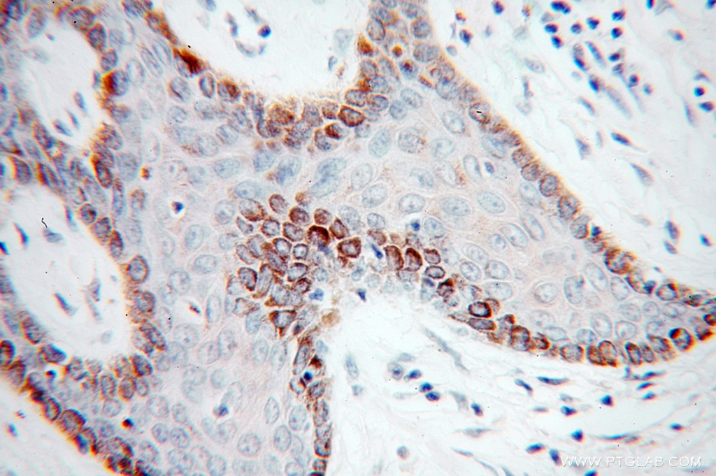 UNR; CSDE1 IHC Immunohistochemical 13319-1-AP UNR; CSDE1 Antibody D1S155E; DKFZp779B0247; DKFZp779J1455; FLJ26882; RP5-1000E10.3; UNR