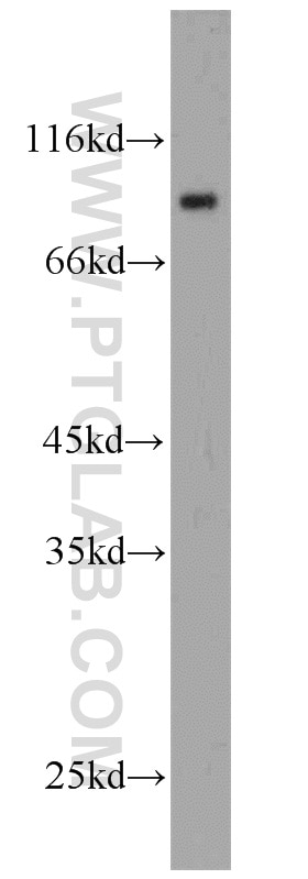 UNR; CSDE1 western blot WB 13319-1-AP UNR; CSDE1 Antibody D1S155E; DKFZp779B0247; DKFZp779J1455; FLJ26882; RP5-1000E10.3; UNR