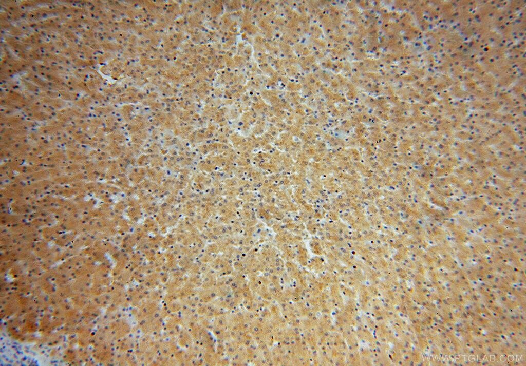 CSNK1G1 IHC Immunohistochemical 16384-1-AP CSNK1G1 Antibody 