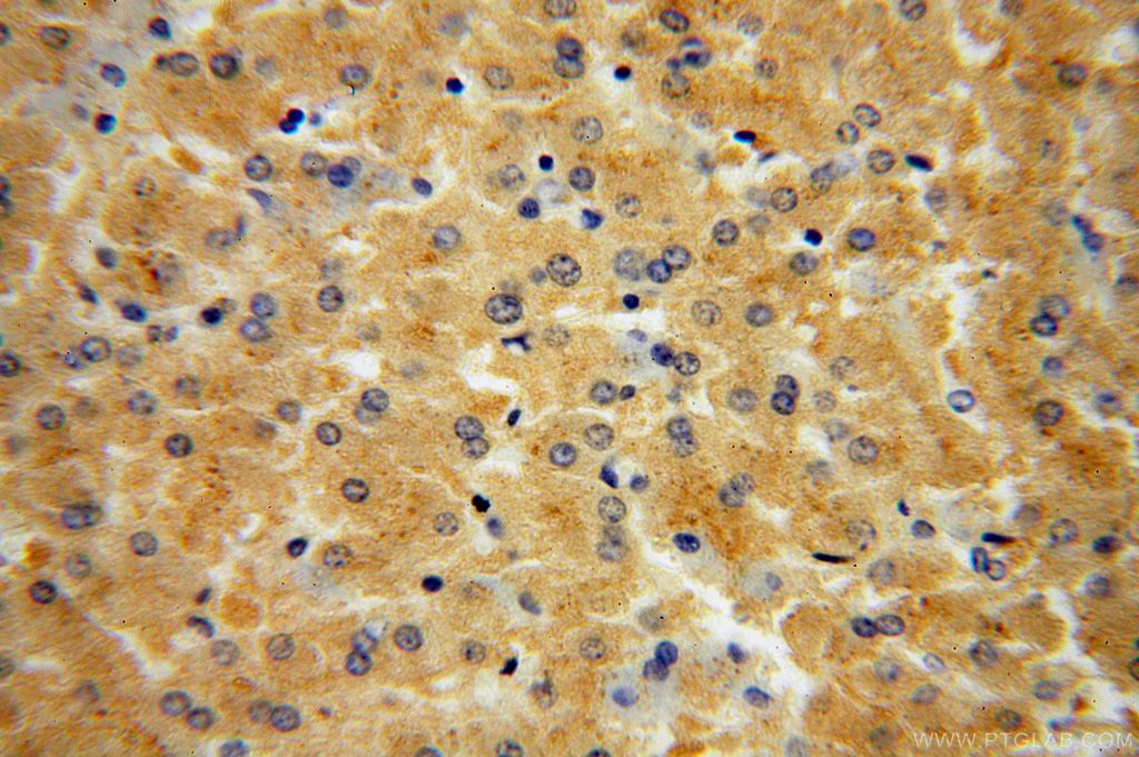 CSNK1G1 IHC Immunohistochemical 16384-1-AP CSNK1G1 Antibody 