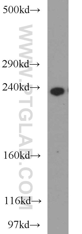 CSPG4,NG2 western blot WB 55027-1-AP CSPG4,NG2 Antibody HMW-MAA; MCSP; MCSPG; MEL-CSPG; MSK16; NG2