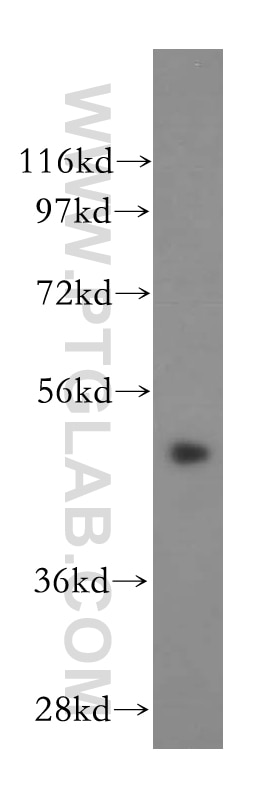CSTF1 western blot WB 15537-1-AP CSTF1 Antibody CSTF1;CstF-50;CstFp50 ;