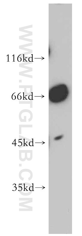 CSE western blot WB 12217-1-AP CSE Antibody CTH;MGC9471 ;CSE