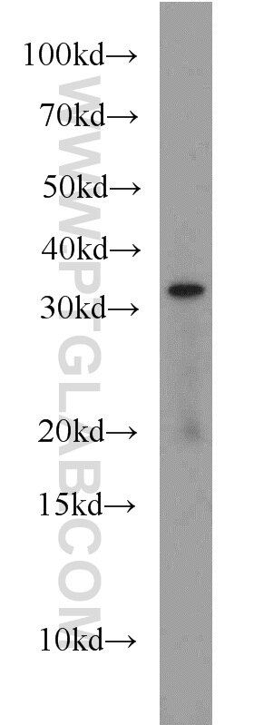 mouse uterus tissue were subjected to SDS PAGE followed by western blot with 11239-1-AP(CTSK Antibody) at dilution of 1:500 CTSK western blot WB 11239-1-AP CTSK Antibody CTS02; CTSO; CTSO1; CTSO2; MGC23107; PKND; PYCD
