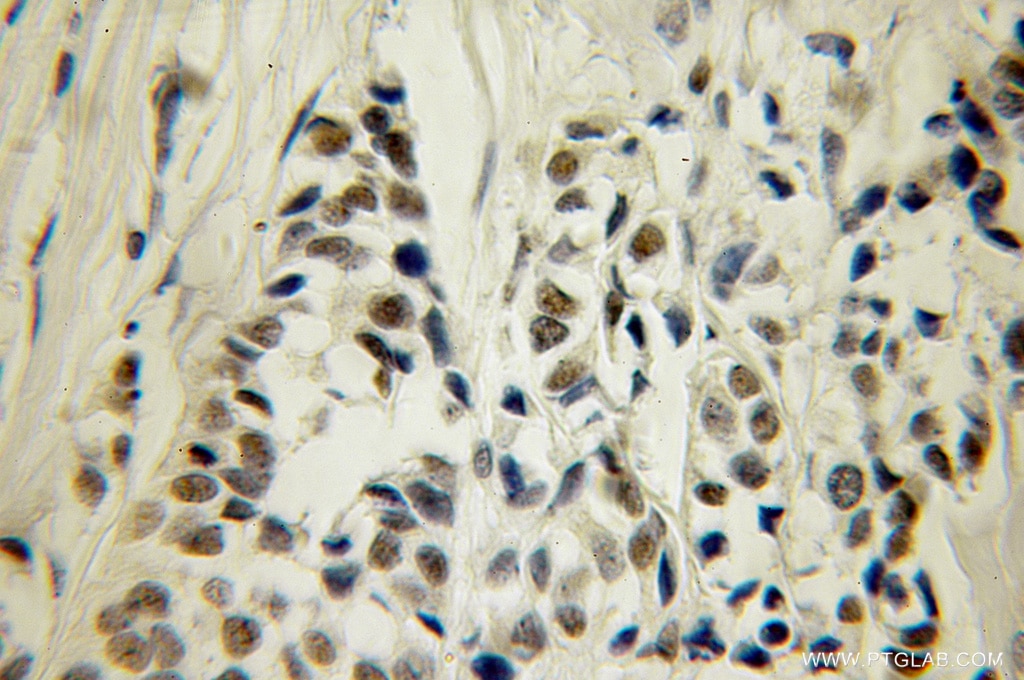 CUGBP1 IHC Immunohistochemical 13002-1-AP CUGBP1 Antibody BRUNOL2; CUG-BP; CUGBP; NAB50; hNab50
