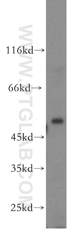 CUGBP1 western blot WB 13002-1-AP CUGBP1 Antibody BRUNOL2; CUG-BP; CUGBP; NAB50; hNab50