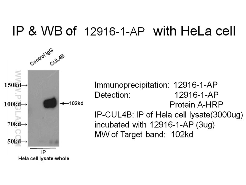 CUL4B IP 12916-1-AP CUL4B Antibody DKFZp686F1470; KIAA0695; MRXHF2; MRXSC; SFM2