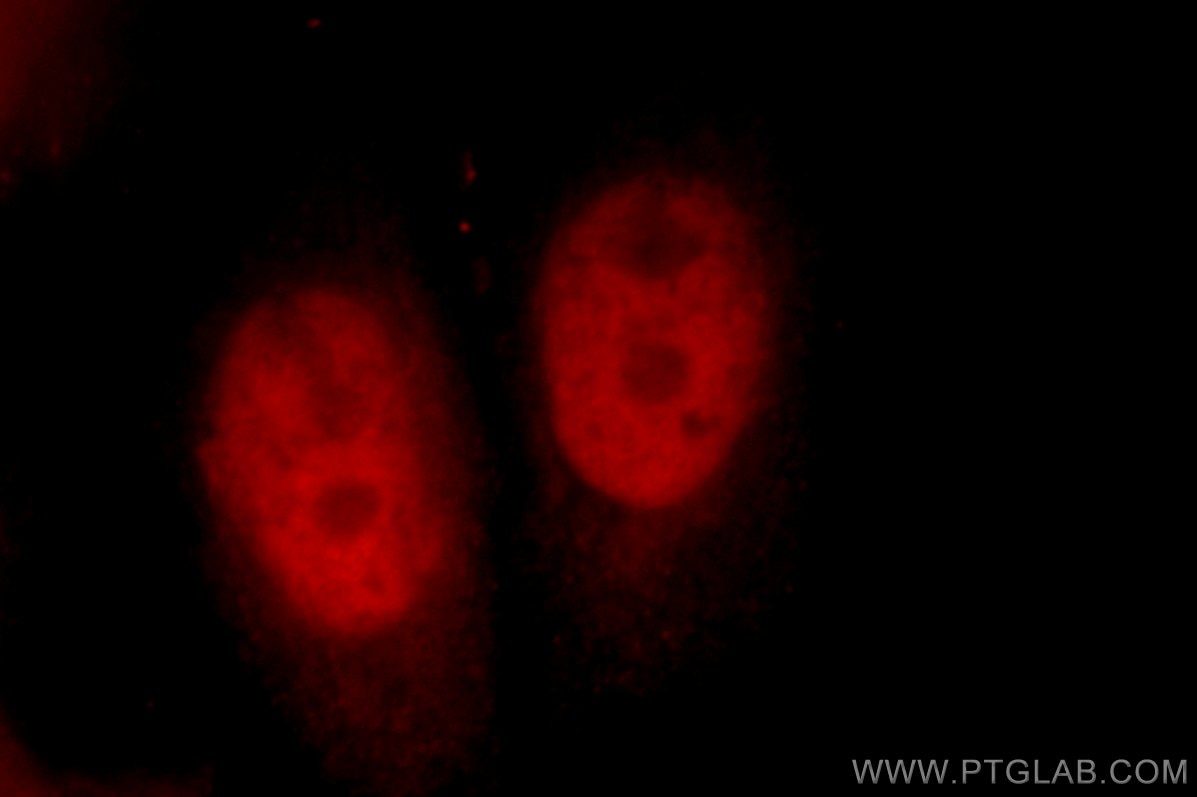 CUL4B Immunofluorescence IF 12916-1-AP CUL4B Antibody DKFZp686F1470; KIAA0695; MRXHF2; MRXSC; SFM2