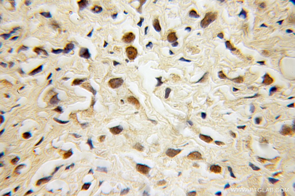 CUL4B IHC Immunohistochemical 12916-1-AP CUL4B Antibody DKFZp686F1470; KIAA0695; MRXHF2; MRXSC; SFM2