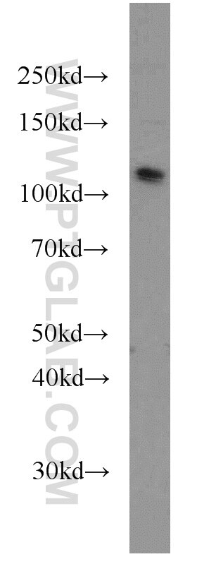 CUL4B western blot WB 12916-1-AP CUL4B Antibody DKFZp686F1470; KIAA0695; MRXHF2; MRXSC; SFM2