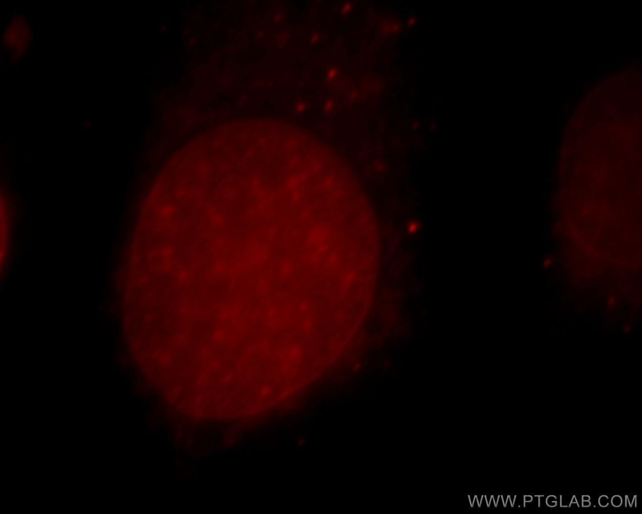 Immunofluorescent analysis of Hela cells, using CUL4B antibody 20882-1-AP at 1:25 dilution and Rhodamine-labeled goat anti-rabbit IgG (red). CUL4B Immunofluorescence IF 20882-1-AP CUL4B Antibody DKFZp686F1470; KIAA0695; MRXHF2; MRXSC; SFM2