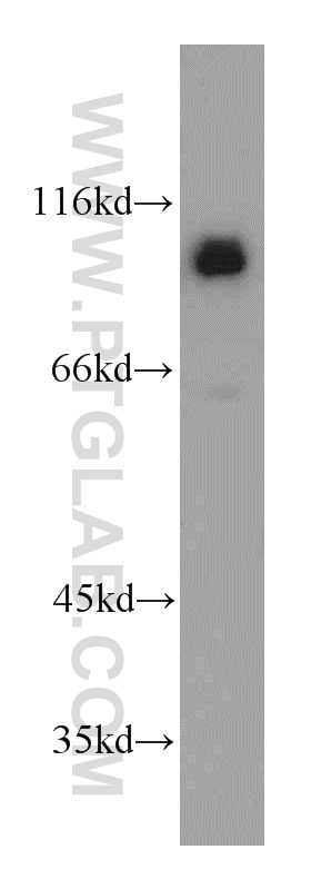 mouse brain tissue were subjected to SDS PAGE followed by western blot with 20882-1-AP(CUL4B Antibody) at dilution of 1:2000 CUL4B western blot WB 20882-1-AP CUL4B Antibody DKFZp686F1470; KIAA0695; MRXHF2; MRXSC; SFM2