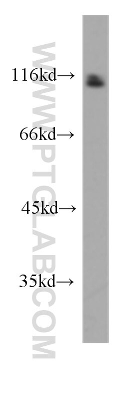 293 cells were subjected to SDS PAGE followed by western blot with 60151-1-Ig(CUL4B Antibody) at dilution of 1:1000 CUL4B western blot WB 60151-1-Ig CUL4B Antibody DKFZp686F1470; KIAA0695; MRXHF2; MRXSC; SFM2