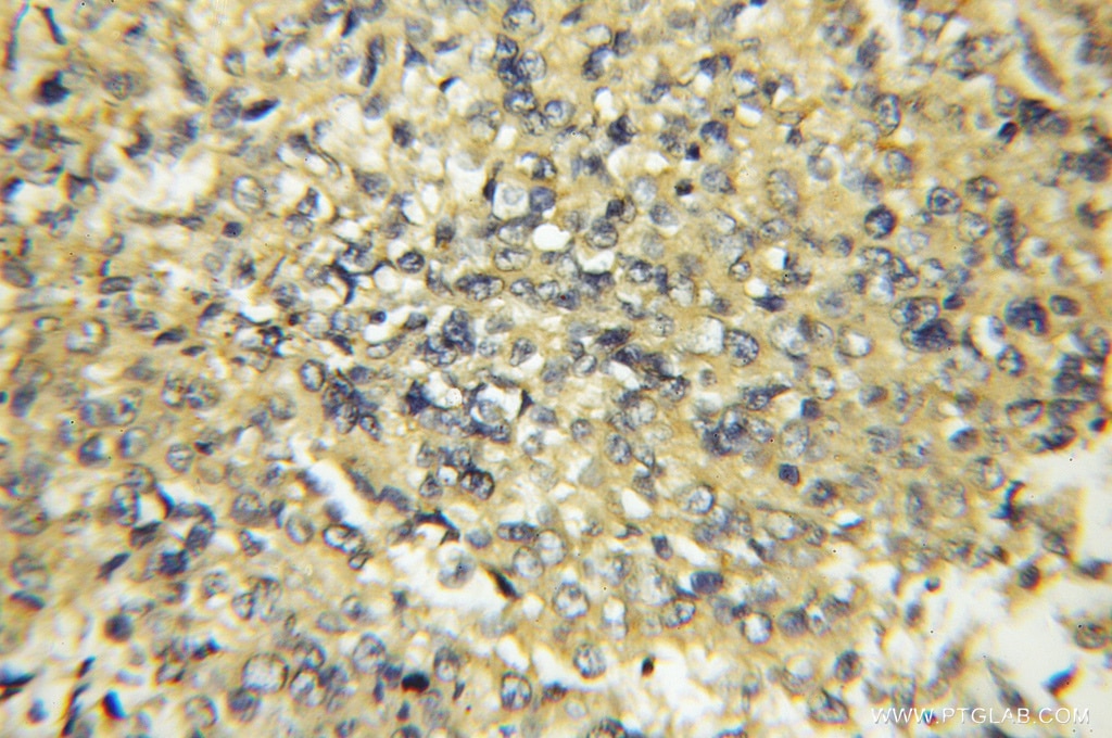 CYB5R3 IHC Immunohistochemical 10894-1-AP CYB5R3 Antibody B5R; DIA1