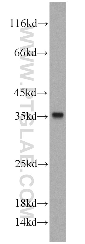 CYB5R3 western blot WB 10894-1-AP CYB5R3 Antibody B5R; DIA1